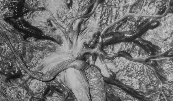 Viscera, 2025, pigment print on canvas, 96.52 x 76.2 cm, courtesy of the artist.